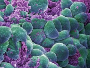 cellule-cancro-300x228