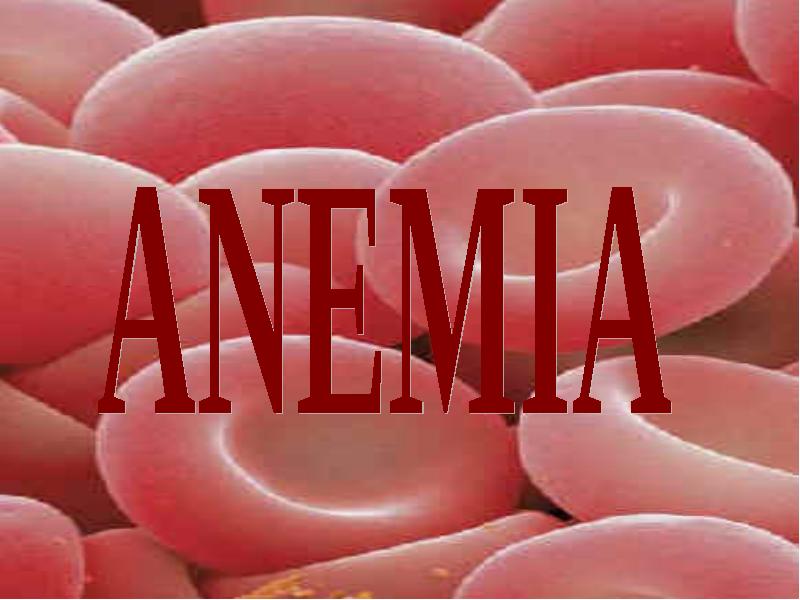 ANEMIA