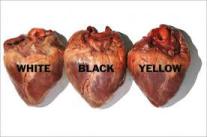 razzismo-cuore