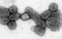 virus influenza spagnola